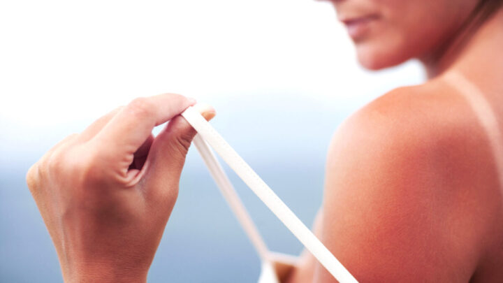 Angsamerah Articles Melindungi kulit dengan sunblock