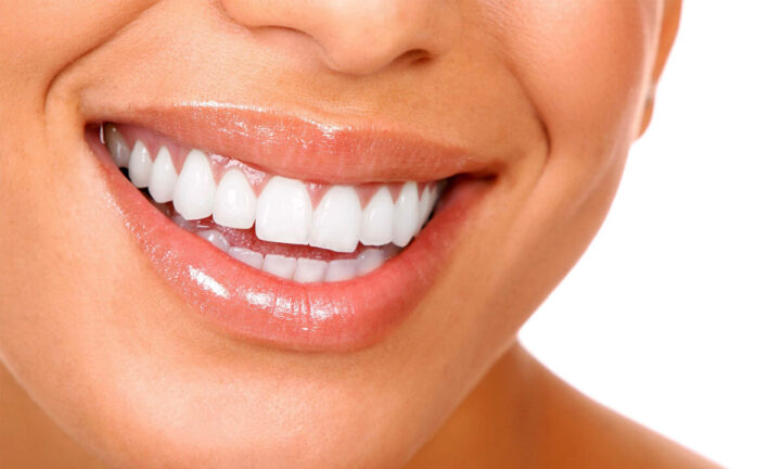 Angsamerah Articles Senyum sehat tanpa karang gigi