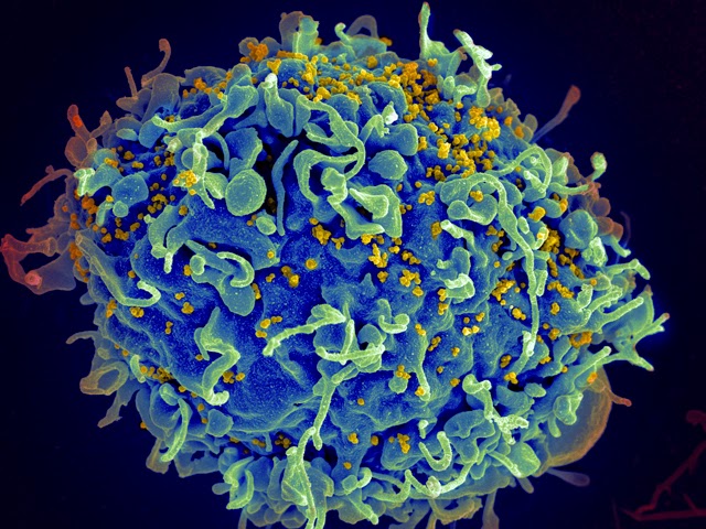 Angsamerah Articles Apa yang dilakukan virus HIV di dalam tubuh manusia